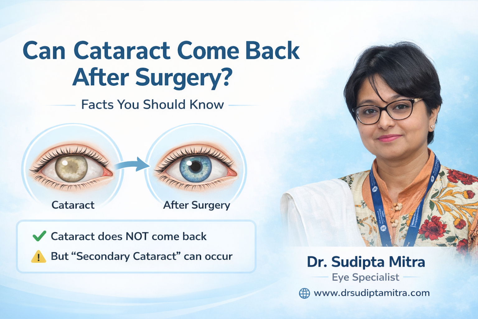 Can Cataract Come Back After Surgery?